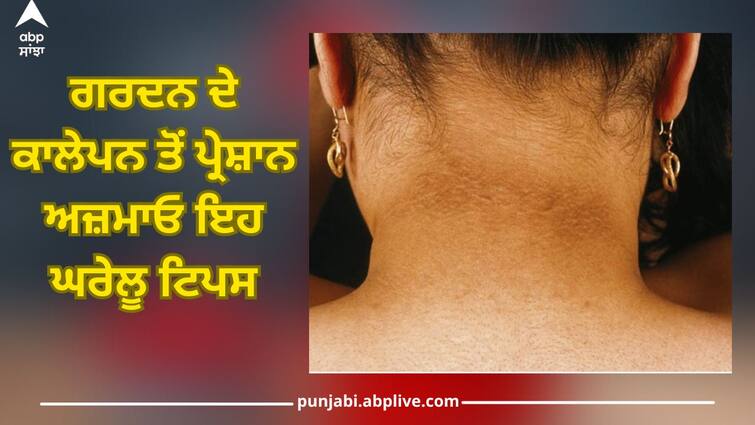 Neck turned black? Try these homemade tips to skin tan removal skin tips Skin Tips: ਗਰਦਨ ਦੇ ਕਾਲੇਪਨ ਤੋਂ ਪ੍ਰੇਸ਼ਾਨ ਅਜ਼ਮਾਓ ਇਹ ਘਰੇਲੂ ਟਿਪਸ, ਪਹਿਲੀ ਵਾਰ 'ਚ ਜਾਵੇਗੀ ਚਮਕ