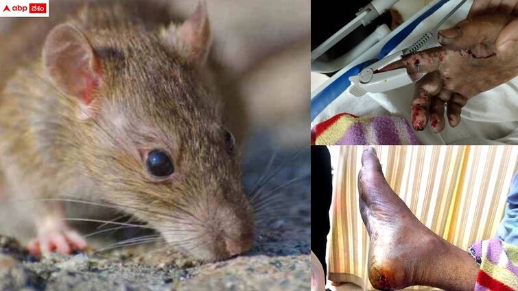 rats bite patients in icu in kamareddy government hospital Kamareddy News: ప్రభుత్వాసుపత్రిలో దారుణం - ఐసీయూలో రోగిన కరిచిన ఎలుకలు, ఎక్కడంటే?