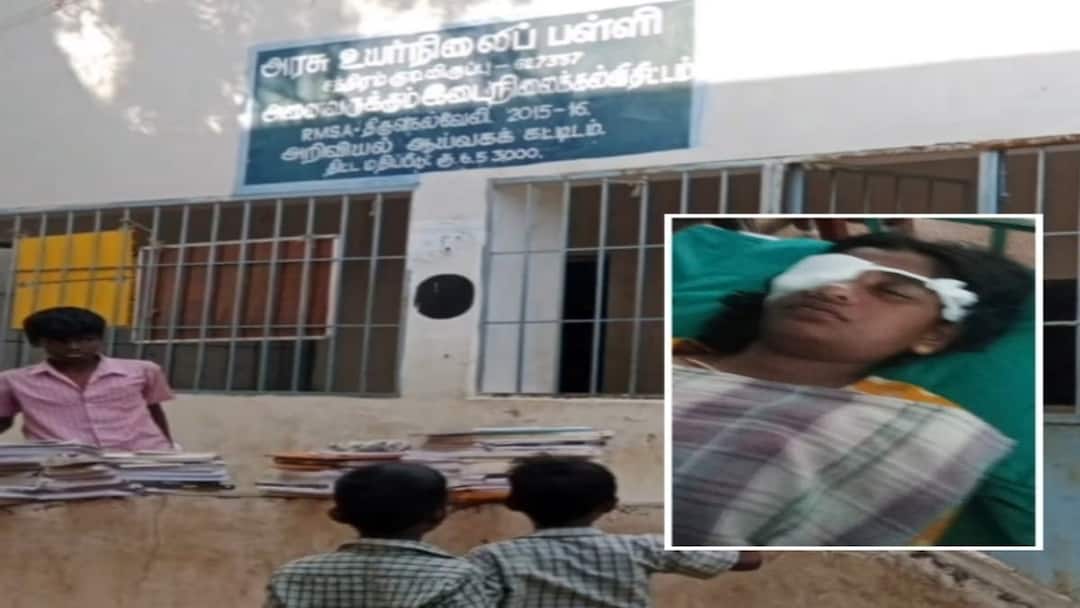 ஆய்வகத்தில் செயல்பட்ட வகுப்பறை.. தவறி விழுந்த ஆசிட் பாட்டிலால் மாணவிக்கு கண் பாதிப்பு - நெல்லையில் சோகம்