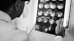 स्ट्रोक को पहचानने में जानें कैसे मदद करता है ये FAST फॉर्मूला