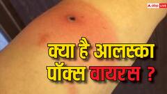 क्या है खतरनाक अलाक्सा पॉक्स वायरस, जानिए ये कैसे फैलता है और इसके लक्षण
