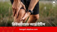 খোঁজ মিলল নয়া ওষুধের! হওয়ার আগেই ঠেকানো যাবে রিউমাটয়েড আর্থ্রাইটিস
