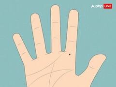 Mole on Palm: उंगली में इस जगह तिल होना माना जाता है लकी, जानें हथेली में तिल से जुड़े रहस्य