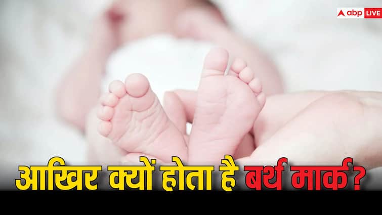 किस वजह से होता है बर्थ मार्क? क्या सच में पिछले जन्म से होता है कोई रिश्ता causes birth marks Is there really any connection with past life किस वजह से होता है बर्थ मार्क? क्या सच में पिछले जन्म से होता है कोई रिश्ता