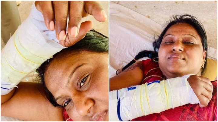 Tamil TV Actress Kambam Meena Injured In Accident Check Health Updates Kambam Meena Injured: तमिल टीवी एक्ट्रेस कम्बम मीना एक्सीडेंट में हुईं घायल, टूटे हाथ के साथ तस्वीरें शेयर कर दिखाई हालत