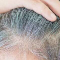 Hair Care: ਸਫੈਦ ਵਾਲ ਕਾਲੇ ਕਰਨ ਲਈ ਵਰਤੋਂ ਇਹ ਘਰੇਲੂ ਨੁਸਖ਼ੇ