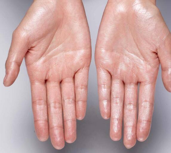 ਦਿੱਲੀ ਦੇ ਰਾਜੀਵ ਗਾਂਧੀ ਹਸਪਤਾਲ ਦੇ ਡਾਕਟਰ ਅਜੀਤ ਜੈਨ ਦਾ ਕਹਿਣਾ ਹੈ ਕਿ ਅੱਜ ਦੇ ਸਮੇਂ ਵਿੱਚ ਫੈਟੀ ਲਿਵਰ ਇੱਕ ਬਹੁਤ ਹੀ ਆਮ ਬਿਮਾਰੀ ਹੁੰਦੀ ਜਾ ਰਹੀ ਹੈ। ਹੁਣ ਲੋਕ ਛੋਟੀ ਉਮਰ ਵਿੱਚ ਵੀ ਇਸ ਬਿਮਾਰੀ ਦਾ ਸ਼ਿਕਾਰ ਹੋ ਰਹੇ ਹਨ। ਫੈਟੀ ਲਿਵਰ ਸ਼ੁਰੂ ਵਿੱਚ ਇੱਕ ਆਮ ਸਮੱਸਿਆ ਹੈ ਪਰ ਬਾਅਦ ਵਿੱਚ ਇਹ ਲਿਵਰ ਸਿਰੋਸਿਸ ਅਤੇ ਲਿਵਰ ਫੇਲ ਹੋਣ ਦਾ ਖਤਰਾ ਵੀ ਵਧਾ ਦਿੰਦੀ ਹੈ। ਸ਼ਰਾਬ ਨਾ ਪੀਣ ਵਾਲੇ ਲੋਕ ਵੀ ਹੁਣ ਫੈਟੀ ਲਿਵਰ ਦੇ ਸ਼ਿਕਾਰ ਹੋ ਰਹੇ ਹਨ। ਇਸ ਦਾ ਮੁੱਖ ਕਾਰਨ ਗਲਤ ਖਾਣ-ਪੀਣ ਦੀਆਂ ਆਦਤਾਂ ਅਤੇ ਵਧਦਾ ਮੋਟਾਪਾ ਹੈ।