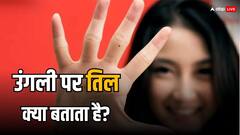 Mole on Palm: उंगली में इस जगह तिल होना माना जाता है लकी, जानें हथेली में तिल से जुड़े रहस्य