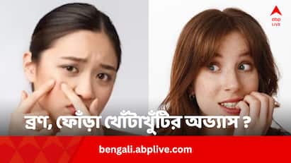 Skin Picking Disorder Causes: ব্রণ, ফোঁড়া হলেই অনেকের খোঁটাখুঁটির অভ্য়াস রয়েছে। এটি কীসের লক্ষণ ? কীভাবে এর থেকে রেহাই মিলবে।