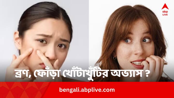 Skin Picking Disorder Causes: ব্রণ, ফোঁড়া হলেই অনেকের খোঁটাখুঁটির অভ্য়াস রয়েছে। এটি কীসের লক্ষণ ? কীভাবে এর থেকে রেহাই মিলবে।