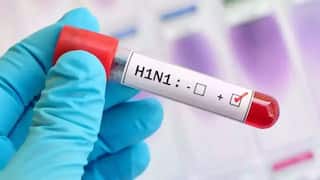 Swine Flu: મહેસાણાના વિસનગરમાં સ્વાઇન ફ્લૂથી એકનું મોત, જાણો કેવા હોય છે લક્ષણો