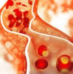 Cholesterol: ਵਧਿਆ ਹੋਇਆ ਕੋਲੈਸਟ੍ਰੋਲ ਆਸਾਨੀ ਨਾਲ ਹੋ ਜਾਵੇਗਾ ਕੰਟਰੋਲ, ਜੀਵਨਸ਼ੈਲੀ 'ਚ ਕਰੋ ਇਹ ਬਦਲਾਅ