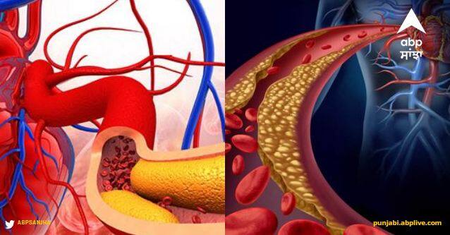 Control Cholesterol: ਜਦੋਂ ਕੋਲੈਸਟ੍ਰੋਲ ਵਧਦਾ ਹੈ ਤਾਂ ਇਹ ਇੱਕ ਗੰਭੀਰ ਸਮੱਸਿਆ ਬਣ ਜਾਂਦਾ ਹੈ। ਇਸ ਕਾਰਨ ਦਿਲ ਦਾ ਦੌਰਾ ਪੈਣ ਦਾ ਖਤਰਾ ਬਣਿਆ ਰਹਿੰਦਾ ਹੈ। ਹਾਈ ਕੋਲੈਸਟ੍ਰੋਲ ਖਰਾਬ ਖਾਣ-ਪੀਣ ਦੀਆਂ ਆਦਤਾਂ ਤੇ ਗਲਤ ਜੀਵਨ ਸ਼ੈਲੀ ਕਾਰਨ ਹੁੰਦਾ ਹੈ