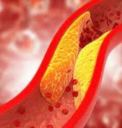 Cholesterol: ਵਧਿਆ ਹੋਇਆ ਕੋਲੈਸਟ੍ਰੋਲ ਆਸਾਨੀ ਨਾਲ ਹੋ ਜਾਵੇਗਾ ਕੰਟਰੋਲ, ਜੀਵਨਸ਼ੈਲੀ 'ਚ ਕਰੋ ਇਹ ਬਦਲਾਅ