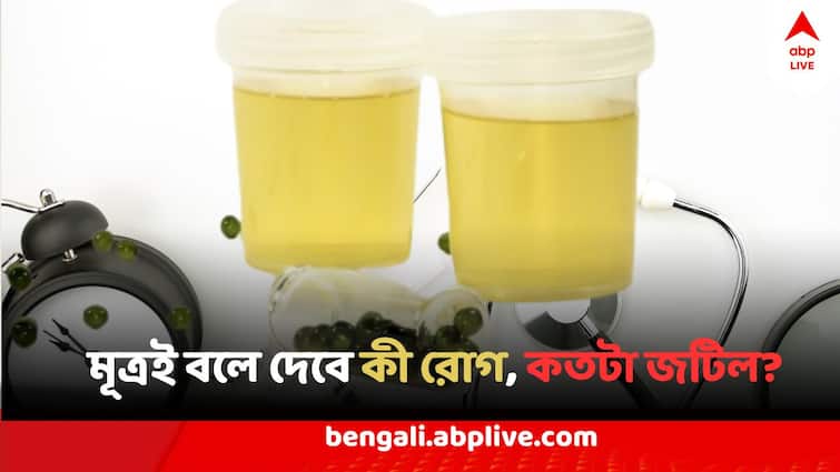 Urine Colour Urine Test Can Tell the disease complexity urine color tells about patients condition Doctors views in Bangla News abpp Urine Color And Health: প্রস্রাবই বলে দিতে পারে আপনি কোন রোগে আক্রান্ত, কতটা কঠিন পরিস্থিতি, এই লক্ষণগুলিকে অবহেলা নয় !