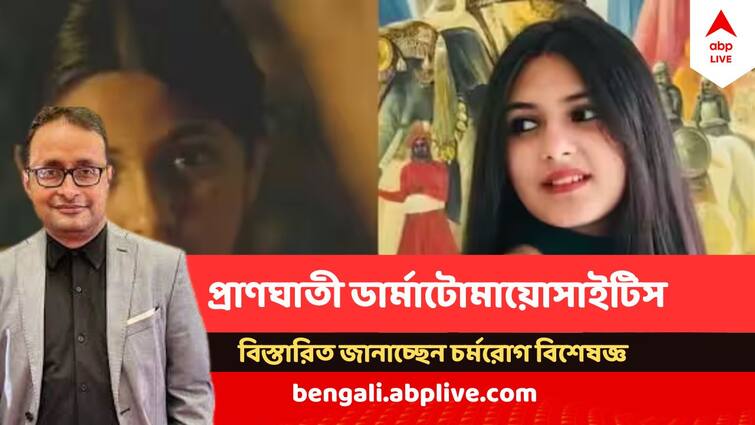 Dermatomyositis Killed 19 years old Dangal Actress Suhani Bhatnagar, what is the disease Dermatomyositis ABP Live Exclusive abpp Actress Suhani Bhatnagar Death: উপসর্গ দেখা দেওয়ার ২ মাসের মধ্যেই মৃত্যু ! কী এই ডার্মাটোমায়োসাইটিস, যা কেড়ে নিল 'দঙ্গল' অভিনেত্রীর প্রাণ?