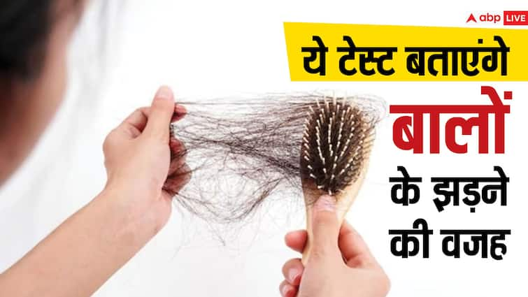 hair care tips 7 blood tests to know hair fall reason in hindi हेयर फॉल की असली वजह जाननी है तो कराएं 7 टेस्ट, तुरंत मिल जाएगा इलाज