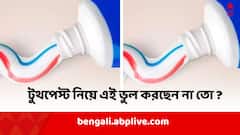 ছ্যাঁকা খেলে এটা ব্যবহার করেন কি ? ঘরোয়া টোটকা ভেবে বিপদ ডেকে আনছেন না তো ?