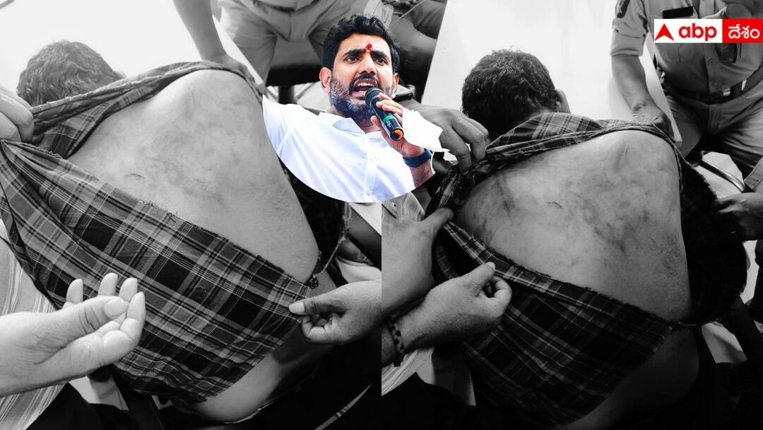 YSRCP supporters attacks photo journalist at Siddham meeting In Rapthadu YS Jagan: సిద్ధం సభలో ఫొటో జర్నలిస్టుపై వైసీపీ శ్రేణుల దాడి! ఫ్యాక్షన్ దాడి అని లోకేష్ ఫైర్