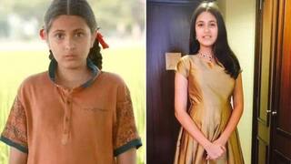 'डर्मेटोमायोसाइटिस' की वजह से गई दंगल गर्ल की जान, स्किन से जुडी ये बीमारी हो सकती है 'जानलेवा, लक्षण दिखते ही हो जाएं सावधान