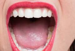 Tongue: ਜੀਭ ਦਾ ਰੰਗ ਖੋਲ੍ਹਦਾ ਸਿਹਤ ਦੇ ਕਈ ਰਾਜ, ਕਿਤੇ ਤੁਹਾਨੂੰ ਇਹ ਬਿਮਾਰੀ ਤਾਂ ਨਹੀਂ?