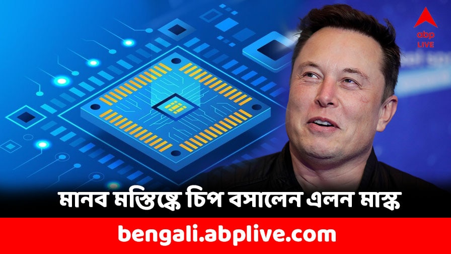 Neuralink: বিশ্বে প্রথম হাত ছাড়াই মাউস চালাল মানুষ ! মাইক্রোচিপ বসিয়ে সফল এলন মাস্ক ?