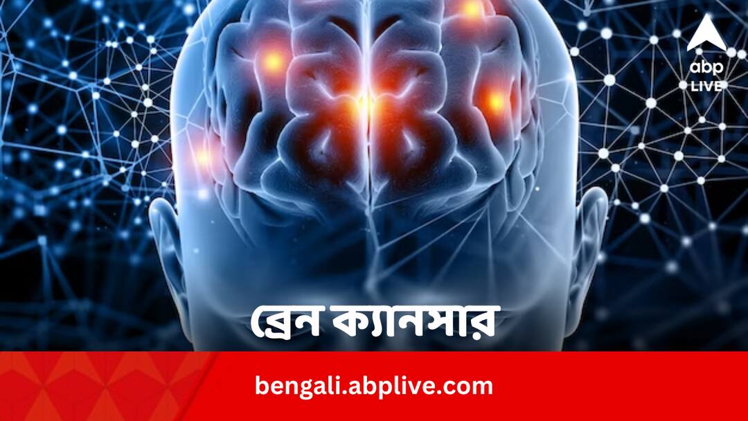 13 year old lucas from belgium survived from deadly brain cancer at trial phase Health News: ভয়ানক ব্রেন ক্যানসারকে হারিয়ে দিল ১৩-এর কিশোর ! সাফল্য ট্রায়ালেই
