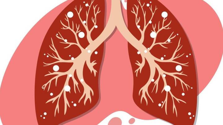 सीएमसी, वेल्लोर के पल्मोनरी मेडिसिन विभाग के प्रोफेसर और इस स्टडी के प्रिंसिपल इंवेस्टिगेटर डॉ. डीजे क्रिस्टोफर (Dr. DJ Christopher) टाइम्स ऑफ इंडिया से खास बातचीत में बताया कि इंडियन मरीजों की हालत दूसरे देशों के मरीजों के मुकाबले काफी ज्यादा खराब है. इनकी तुलना हम यूरोपियन और चीन के लोगों से करें तो यह आंकड़े बेहद खराब है. भारतीयों में डायबिटीज और बीपी की परेशानी दूसरे देशों के मुकाबले काफी ज्यादा है.