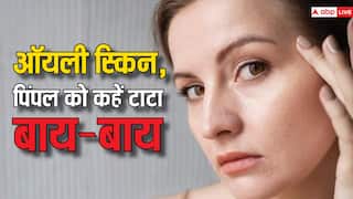अगर आप भी पिंपल और ऑयली स्किन से हैं परेशान तो कर लीजिए इन चीजों से परहेज