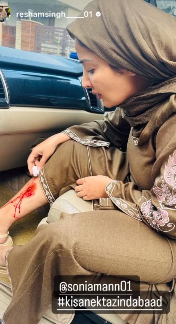 ਕਿਸਾਨ ਅੰਦੋਲਨ ਦੌਰਾਨ ਅਦਾਕਾਰਾ ਸੋਨੀਆ ਮਾਨ ਹੋਈ ਜ਼ਖਮੀ