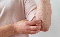 Health: ਤੇਜ਼ੀ ਨਾਲ ਬੱਚਿਆਂ ‘ਚ ਫੈਲ ਰਹੀ ਇਹ ਬਿਮਾਰੀ, ਜਾਣੋ ਇਸ ਦੇ ਲੱਛਣ