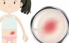 Health: ਤੇਜ਼ੀ ਨਾਲ ਬੱਚਿਆਂ ‘ਚ ਫੈਲ ਰਹੀ ਇਹ ਬਿਮਾਰੀ, ਜਾਣੋ ਇਸ ਦੇ ਲੱਛਣ