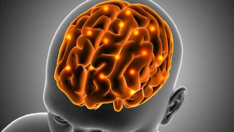 A brain hemorrhage is a medical emergency that requires immediate treatment क्या होता है जब दिमाग की नसें फट जाती हैं? जानें इसके लक्षण और कारण
