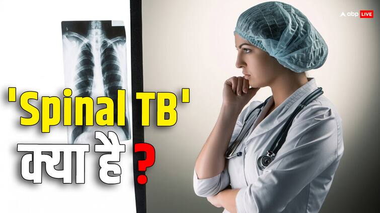 know what is  spinal tuberculosis and its symptoms स्पाइनल टीबी की शिकार महिला ने दिया बच्चे को जन्म, जानिए क्या है ये बीमारी और इसके लक्षण