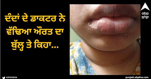 dentist chopped off womans lip says she looked good and laughed Viral News: ਦੰਦਾਂ ਦੇ ਡਾਕਟਰ ਨੇ ਵੱਢਿਆ ਔਰਤ ਦਾ ਬੁੱਲ੍ਹ, ਕਿਹਾ- ਚੰਗੇ ਲੱਗ ਰਹੇ ਹੋ ਅਤੇ ਹੱਸਣ ਲੱਗ ਪਿਆ