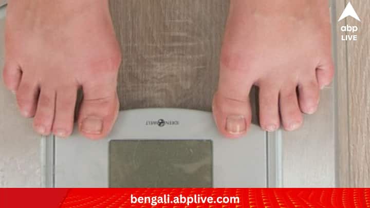 একটি বিষয় মনে রাখা দরকার। স্বাস্থ্যকর উপায়ে ওজন ঝরাতে কিছুটা সময় লাগে। সেই সময়টুকু নিজেকে দিতে হবে। আর গোড়ায় এই কয়েকটি অভ্যাস তৈরি করতে পারলে কিছুটা সুফল মেলার কথা। তবে কারও কারও ক্ষেত্রে অন্যরকম কিছু হলে অবশ্যই ডাক্তারের কাছে যান।    (ছবি:PIXABAY)