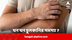 ঘন ঘন চুলকানির সমস্যা ? কোনও গুরুত্বপূর্ণ অঙ্গ অসুস্থ ?