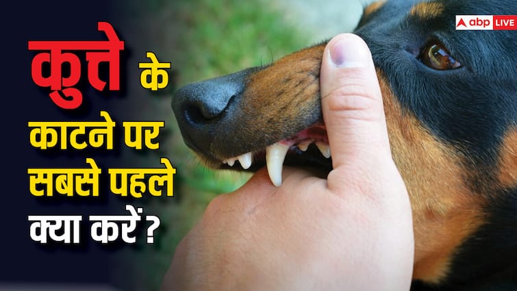 know first ad for dog bite do these things for dog bite अगर कुत्ता काट ले तो तुरंत क्या करना चाहिए? यहां जानें इलाज का हर तरीका