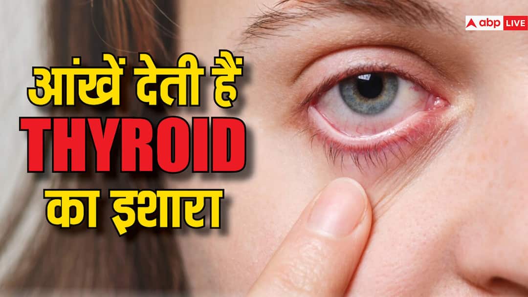 health tips thyroid eye disease causes symptoms signs treatment in hindi आपकी आंखें ही बता देती हैं कि बढ़ रहा है Thyroid, जानें क्या हैं वार्निंग साइन