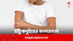 হাঁটু, কনুই কালচে থাকবে না আর ! হেঁশেলের ৫ উপকরণেই সুফল