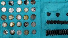 पेट में 39 सिक्के और चुंबक के 37 टुकड़े, मरीज ने कहा- जिंक की कमी दूर करने के लिए खाया था