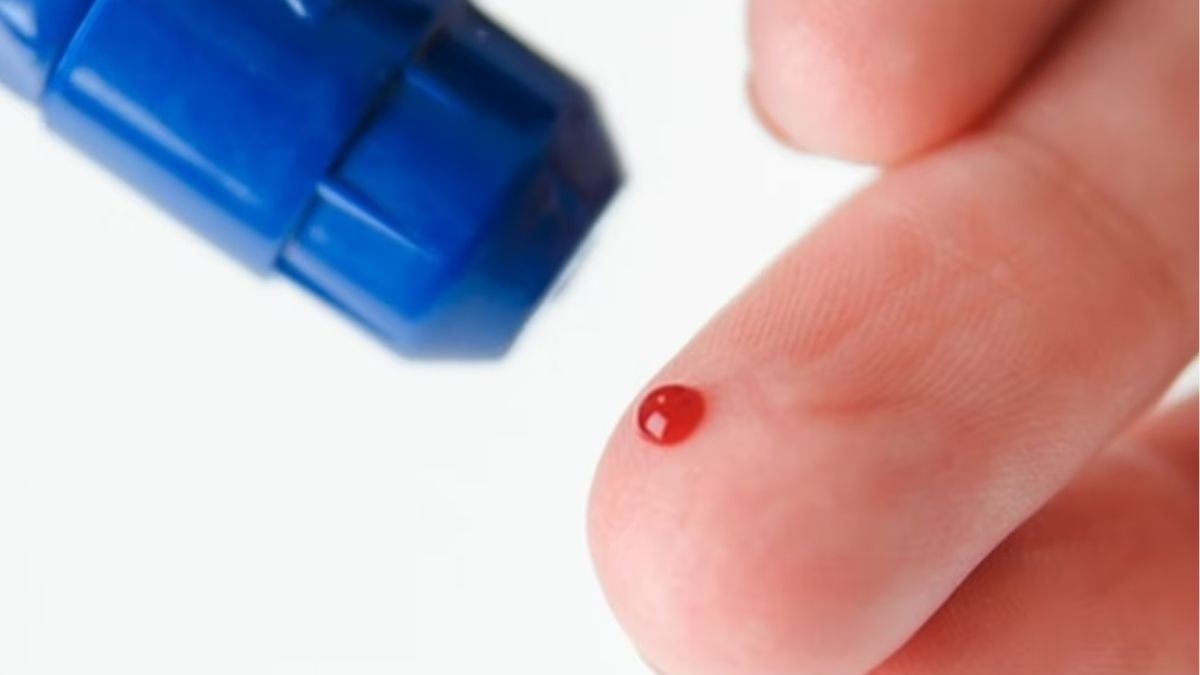 Ingrown Fingernail Treatment: At-Home and When to See a Healthcare Provider