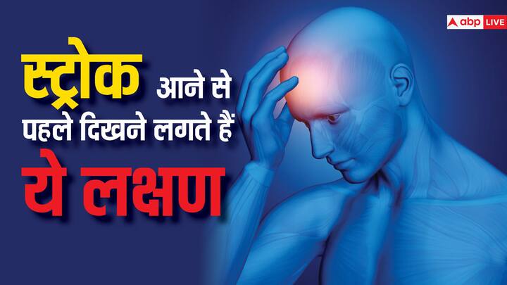 health tips early warning signs and symptoms of stroke in hindi Stroke आने के 7 वॉर्निंग साइन, 7 दिन पहले ही आने लगते हैं नजर, दिखते ही भागें डॉक्टर के पास