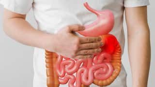 Stomach Flu: दिल्ली में तेजी से फैल रही है पेट की यह खतरनाक बीमारी, जानें इसके लक्षण