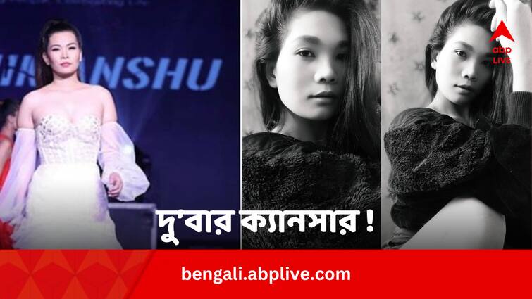 Why Rinky Chakma Diagnosed With Cancer Second Time Know From Expert Rinky Chakma Death: একবার সেরে উঠলেও ফের ক্যানসার হয় মিস ইন্ডিয়া রিঙ্কির, কেন ?