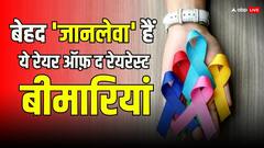 भारत में रेयर ऑफ द रेयरेस्ट हैं ये 5 बीमारियां, 10 हज़ार में से एक होता है इनका शिकार, बन सकती हैं 'जानलेवा'