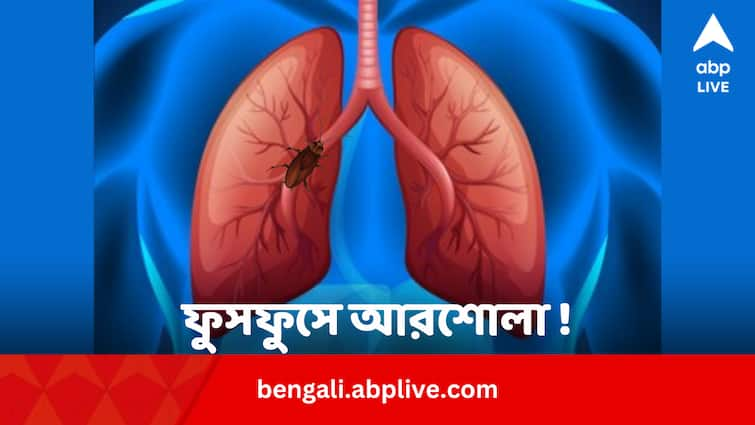 Kerala Doctors Found 4 cm Cockroach In Lungs Know How the Man Saved Viral News:  প্রবল শ্বাসকষ্ট, ডাক্তারের কাছে যেতেই ফুসফুসে মিলল আরশোলার বাসা ! তার পর…