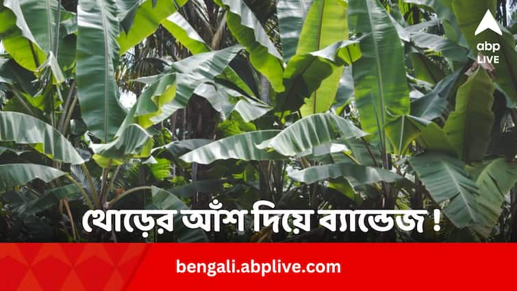 Indian Scientists Used Banana Fiber To Make Bandage Know What Lead Researcher Says To ABP Ananda Health Update: কলাগাছের আঁশ দিয়ে ব্যান্ডেজ ! নয়া খোঁজ ভারতীয় গবেষকদের