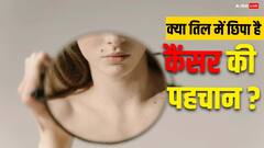 क्या आपके शरीर पर भी है तिल, कैंसर की निशानी को जानने के लिए इन लक्षणों को पहचानें