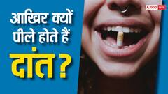 इन वजहों से पीले होते हैं दांत, जानें इससे किन बीमारियों का खतरा